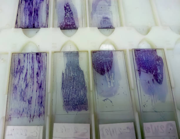 istock Histological stained slides isolated in laboratory, histopathology 1338185864