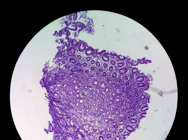 istock A histological slide of a tissue sample. Close microscopic view. Histopathology 1338186066
