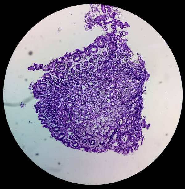 istock A histological slide of a tissue sample. Close microscopic view. Histopathology 1338186068