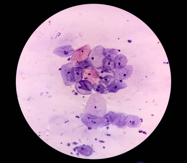 istock Microscopic view of normal human cervix cells. Squamous epithelial cells. Pap smear. pap's. SCC 1338187002