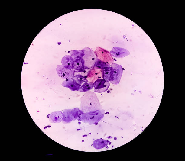istock Microscopic view of normal human cervix cells. Squamous epithelial cells. Pap smear. pap's. SCC 1338187004