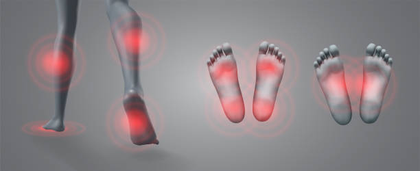 vector legs on background vector set of legs with red patches of pain on a gray background doctor ankle stock illustrations