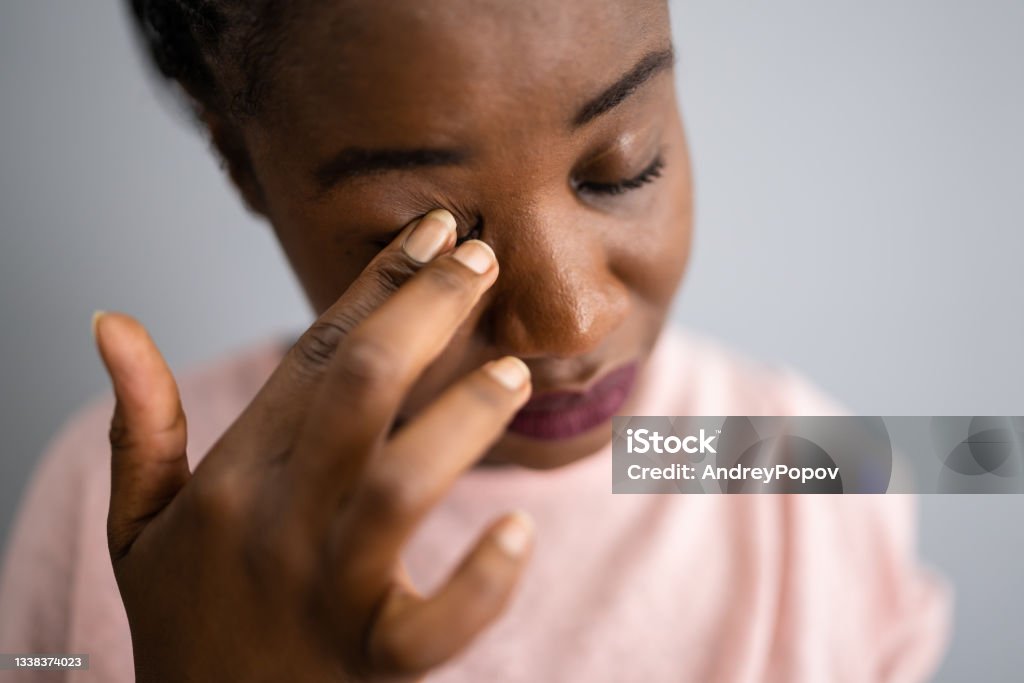 Eye Pain And Spasm Symptoms. Girl Face Eye Pain And Spasm Symptoms. Girl Face With Itching Eye Stock Photo