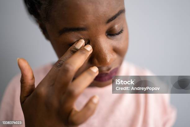 Eye Pain And Spasm Symptoms Girl Face Stock Photo - Download Image Now - Eye, Scratching, Conjunctivitis