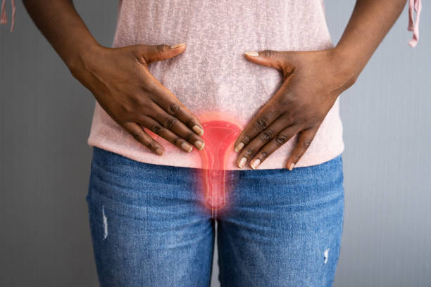 Uterine System Pain And Pregnancy African Person Uterine System Pain And Pregnancy endometriosis black women stock pictures, royalty-free photos & images
