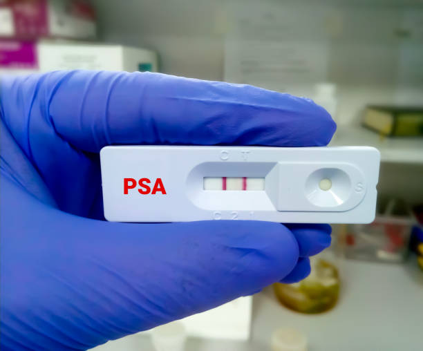 istock Rapid diagnostic test for PSA (Prostate Specific Antigen) with a positive result. Rapid test cassette 1338476532
