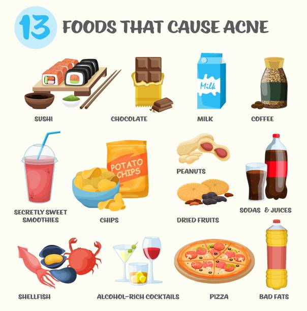 co powoduje trądzik. pokarm powodujący trądzik. ilustracja wektorowa - lubrication infection stock illustrations