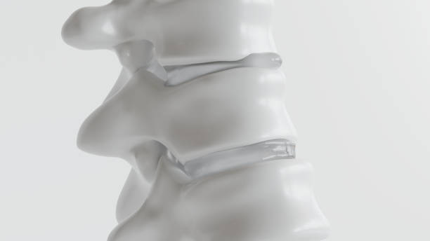 Spinal disc herniation as close-up as 3D Rendering Spinal disc herniation as close-up as 3D Rendering animal back stock pictures, royalty-free photos & images