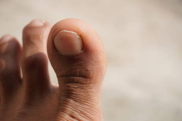 istock finger of feet close up image 1338700436