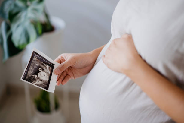 pregnant woman holding ultrasound baby scan image - abdomen gynecological examination women loving imagens e fotografias de stock