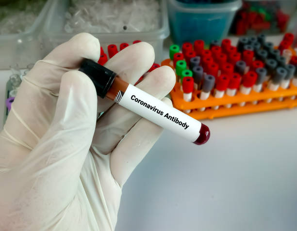 istock Antibody testing for coronavirus infection. Checking the population for immunity to covid 19. A test tube with a blood test in the hand of a scientist with laboratory background 1338729807
