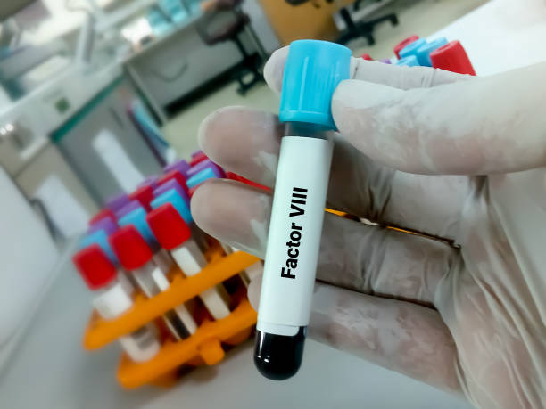 istock Blood Sample for Factor VIII. Blood coagulation testing. Medical or health concept. coagulation factor test. Antihemophilia factor A test 1338794058