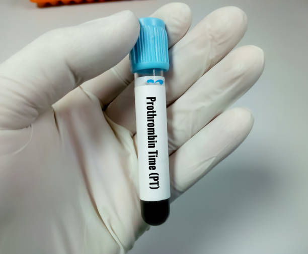 istock Blood Sample for Prothrombin time (PT). Blood coagulation testing. Medical or health concept. PTT. 1338794082