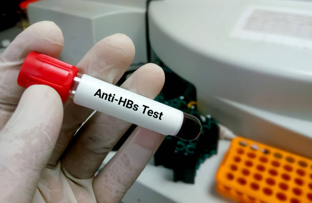 Blood sample for anti-HBs test (Hepatitis B immunity status). Hepatitis B surface antibody testing stock photo
