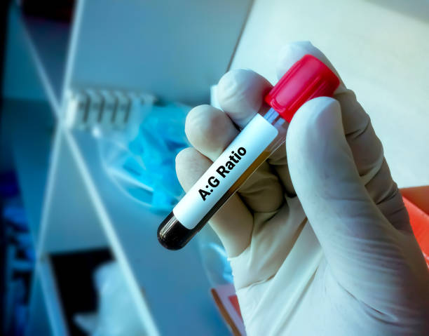istock Blood sample for AG Ratio (Albumin Globulin Ratio) test, diagnosis for liver disease 1338800270