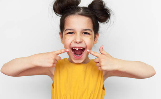 Happy preschooler little girl in yellow dress showing empty space with growing first permanent molar isolated on grey studio background. Cute kid missing primary baby tooth. Child has lost milk tooth. stock photo