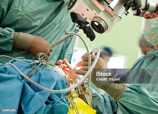 Los Cirujanos Realiza Procedimiento Quirúrgico Foto de stock y más banco de imágenes de Neurocirugia - Neurocirugia, Microscopio, Cirugía