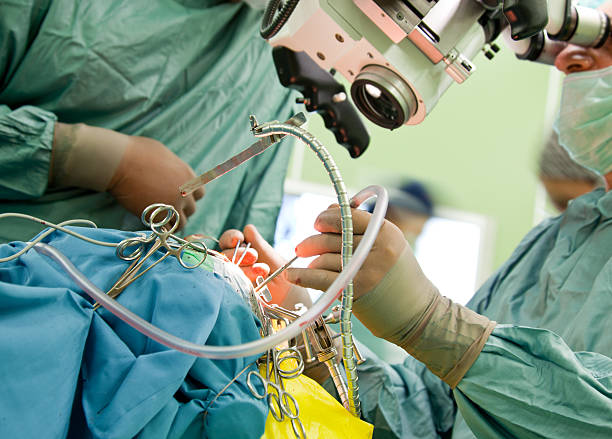 외과의는 수술 절차를 수행하는 - 신경외과 뉴스 사진 이미지