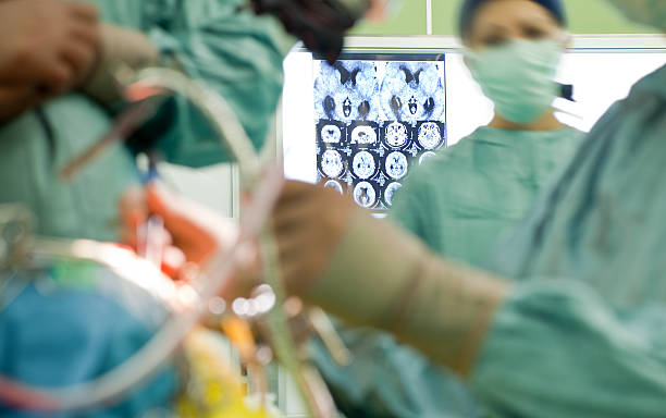 x-ray brain surgery Blurred figures of people in medical uniforms performing brain surgery, focus on x-ray neurosurgery photos stock pictures, royalty-free photos & images