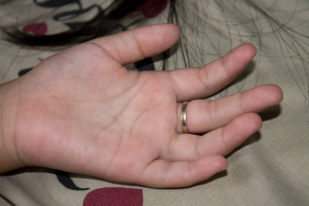 istock little girl palm 1339207470