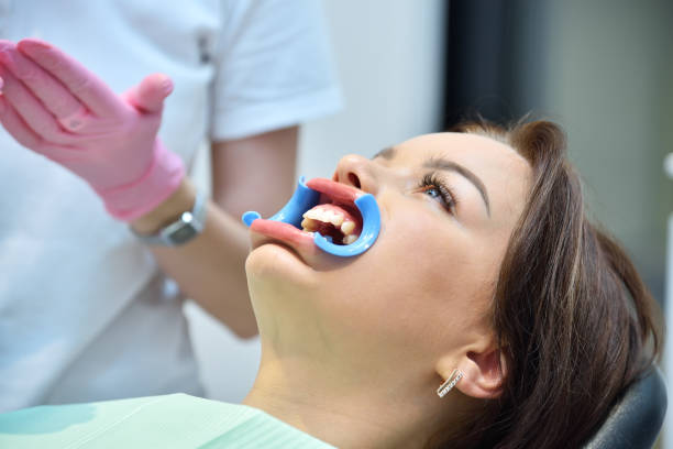 istock Patient with a dental retractor in mouth 1339243346