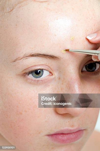 Concealer - Fotografias de stock e mais imagens de Acne - Acne, Adolescente, Amarelo