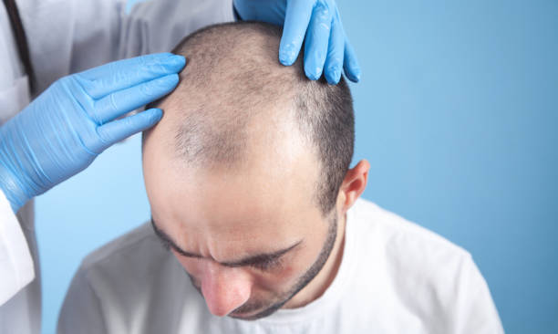 Doctor hands on patient head. Hair growth stock photo