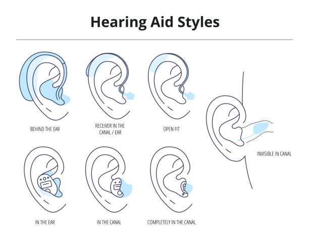 Types of hearing aids for the hearing impaired and the deaf.Different hearing aid technology.Vector flat illustration Types of hearing aids for the hearing impaired and the deaf.Different hearing aid technology.Vector flat illustration.Behind,receiver,in the ear,open fit,in the canal,invisible,completely. ear canal stock illustrations