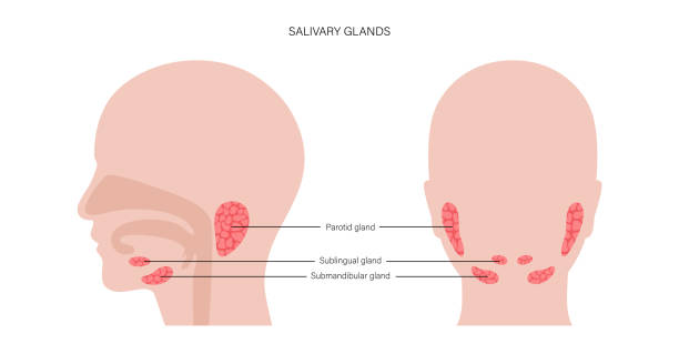 Salivary gland concept Salivary gland in human mouth. Parotid, submandibular, and sublingual glands. Produce of saliva through a system of ducts. Xerostomia oral disease anatomical poster. Medical flat vector illustration. salivary gland surgery stock illustrations
