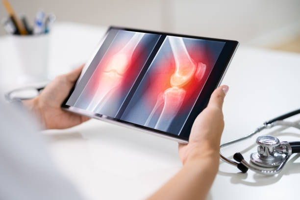 istock Surgeon Doctor Looking At Knee Xray Bone Scan 1339597858