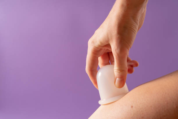 istock Self-cupping therapy. Anti-cellulite massage with a vacuum cup. Vacuum jar massage. Silicone jars for vacuum therapy. 1339618748
