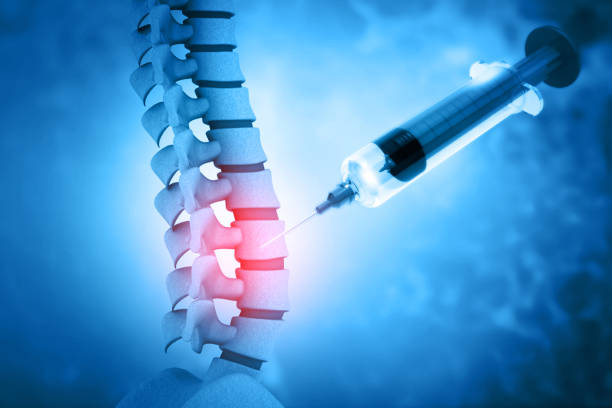 ilustración 3d de una inyección de columna lumbar - injecting fotografías e imágenes de stock