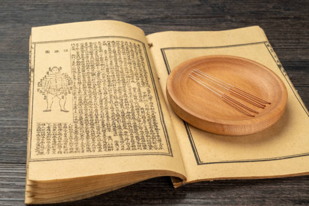 침술은 중국 전통 의학입니다. - chinese medicine medicine ancient herbal medicine 뉴스 사진 이미지