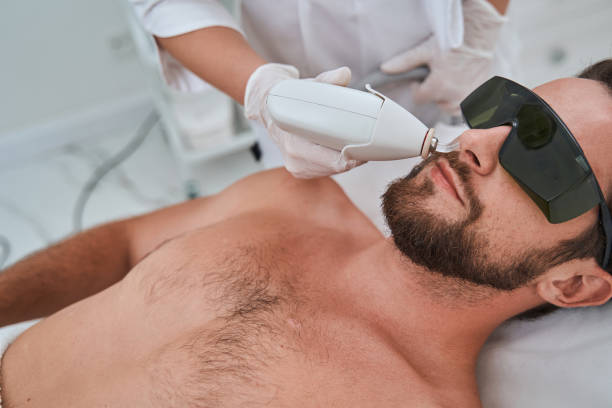 istock Young guy in protective eyeglasses during a cosmetic procedure 1339725410