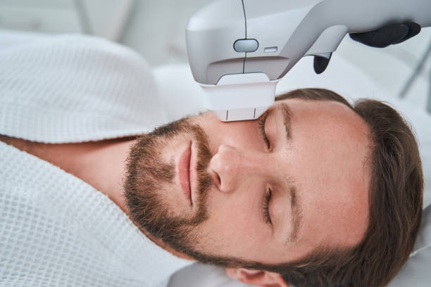 bearded mustached dark-haired man dozing during a non-invasive face-lift procedure - lifting device imagens e fotografias de stock