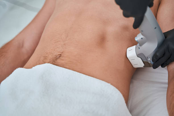 istock Male patient undergoing the non-invasive body contouring 1339725470