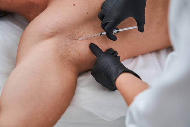 istock Female doctor treating her patient for hyperhidrosis 1339725502