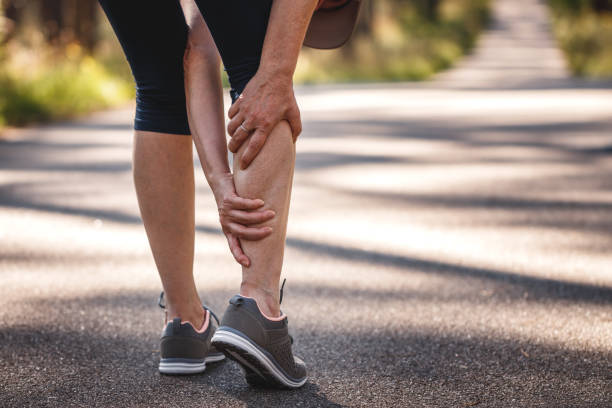 Calf muscle cramp during running Woman feeling pain of her legs during jogging. Calf muscle cramp. Underestimating the warm-up exercise before running muscular build stock pictures, royalty-free photos & images