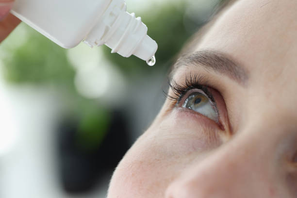 Woman dripping into her eyes with antibacterial drops closeup Woman dripping into her eyes with antibacterial drops closeup. Treatment of viral conjunctivitis concept eyedropper stock pictures, royalty-free photos & images