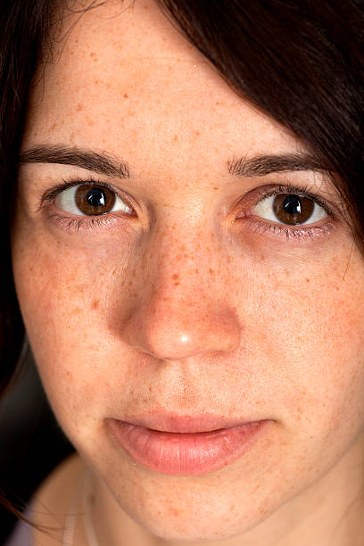 istock Face with freckles 133998187