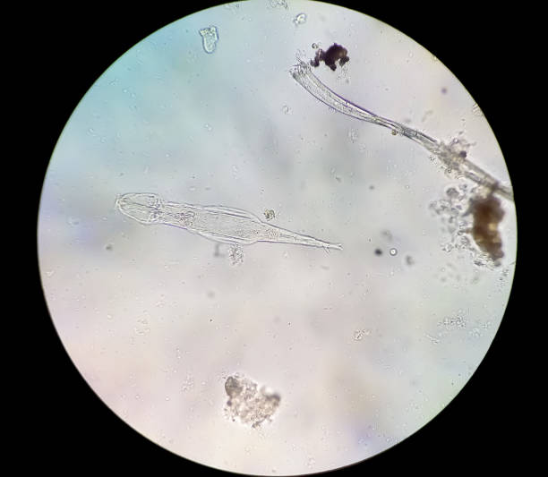 Schistosoma Haematobium Parasite in human urine specimen under microscope. Urinary parasite stock photo