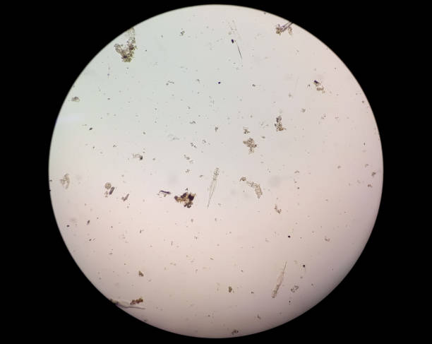 istock Schistosoma Haematobium Parasite in human urine specimen under microscope. Urinary parasite 1340253271