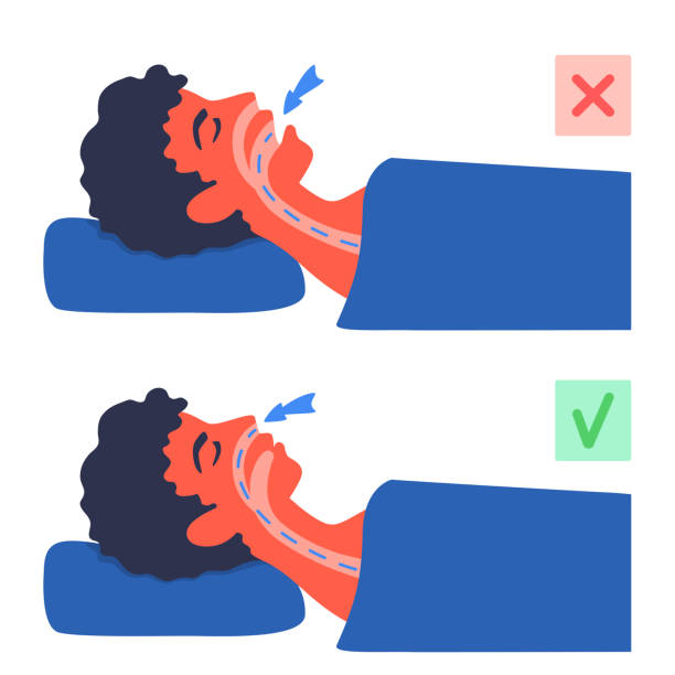 ilustraciones, imágenes clip art, dibujos animados e iconos de stock de respirar dormido. un hombre acostado boca 200 con la boca abierta y cerrada. flujo de aire incorrecto y correcto. aire que pasa por la nariz y la boca. ronquidos, problema de apnea del sueño. - mouth open illustrations