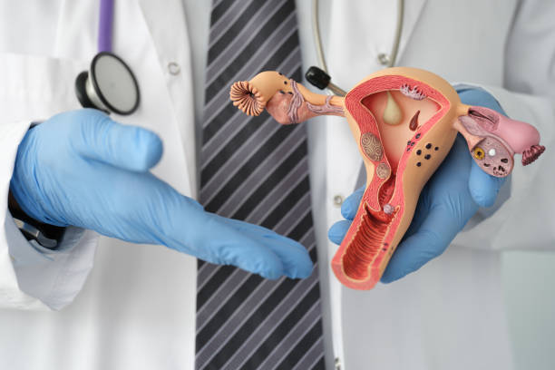 médico con guantes de goma sosteniendo maquetas de plástico del útero femenino en primer plano clínico - vagina contraceptive gynecologist doctor fotografías e imágenes de stock