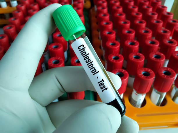 tubo de muestra de sangre de sangre para la prueba de colesterol. - cholesterol fotografías e imágenes de stock