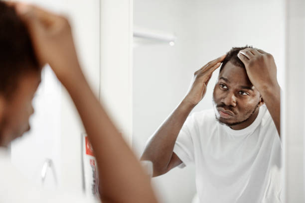 homem preocupado com a queda de cabelo - mirror men depression african descent - fotografias e filmes do acervo