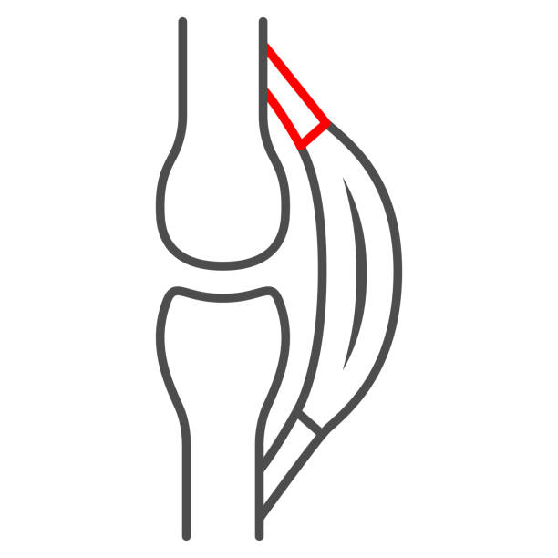 ilustrações, clipart, desenhos animados e ícones de ícone de linha fina do tendão esticado, conceito de dor no corpo, sinal de vetor de tensão no fundo branco, ícone de estilo de contorno para conceito móvel e web design. desenho vetorial. - tendon