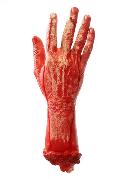 Photo of Bloody hand