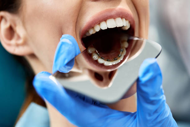 primer plano del ortodoncista revisando los aparatos linguales de la paciente femenina con un espejo. - lingual fotografías e imágenes de stock