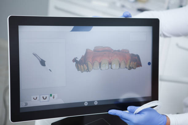 istock Dental scanner at dentists office 1340912115